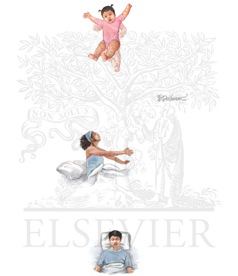 EPILEPSY SYNDROMES