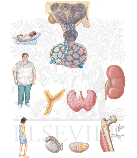 OVERVIEW OF HYPOTHALAMIC FUNCTION AND DYSFUNCTION: OVERVIEW OF HYPOTHALAMIC AND PITUITARY DISEASE