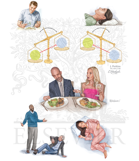 NARCOLEPSY: A HYPOTHALAMIC SLEEP DISORDER