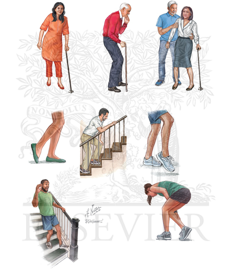 Watermarked preview of unlabeled image: GAIT DISORDERS: DIFFERENTIAL DIAGNOSIS (Continued)