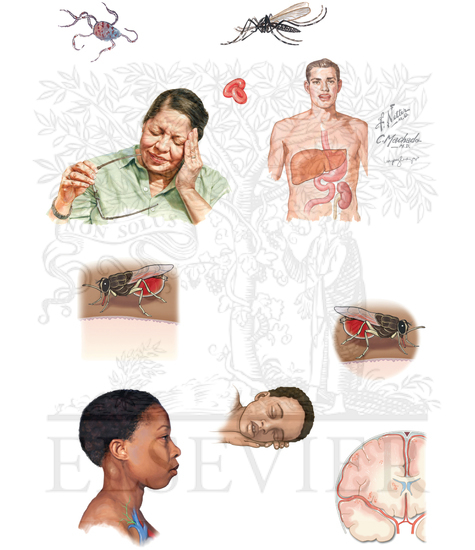 PARASITIC INFECTIONS: CEREBRAL MALARIA AND AFRICAN TRYPANOSOMIASIS