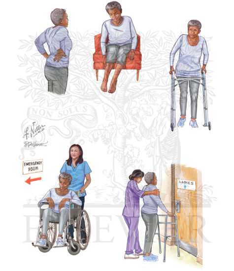 SYMPTOMS OF ACUTE SPINAL CORD SYNDROME EVOLUTION