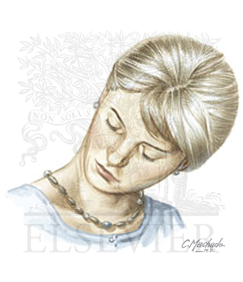 Watermarked preview of unlabeled image: TRIGEMINAL AUTONOMIC CEPHALALGIAS 