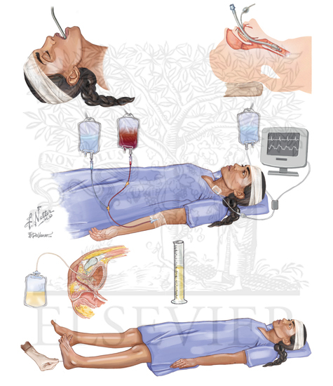 INITIAL ASSESSMENT AND MANAGEMENT OF HEAD INJURY (ABC)