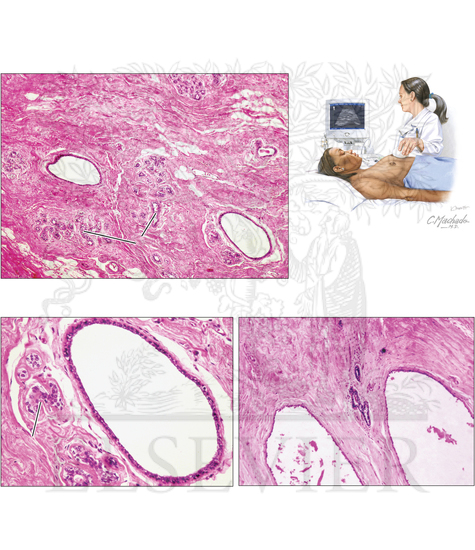 Histology of Atrophic Mammary Glands
