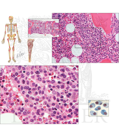 Pathology of Blood and Bone Marrow