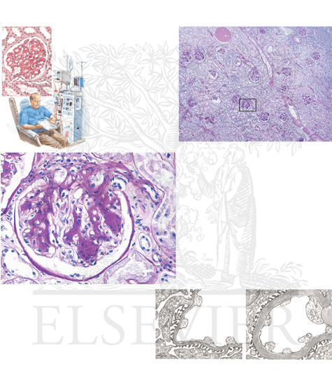 Pathology of the Urinary System