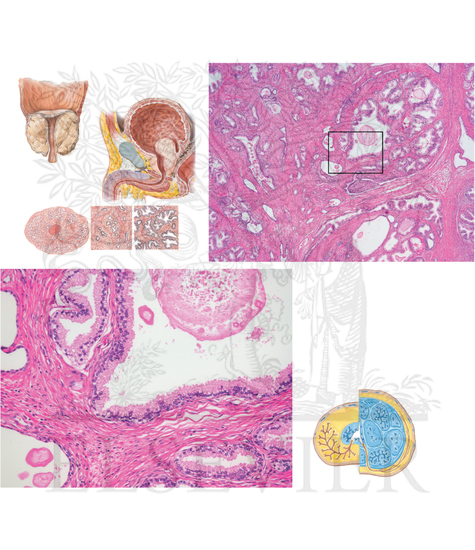 Pathology of Male Reproductive System