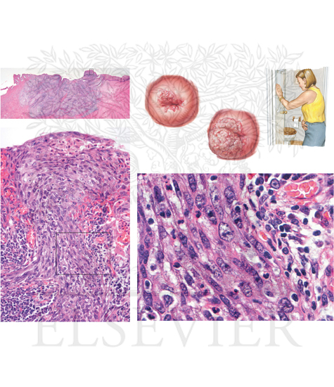 Pathology of Female Reproductive System