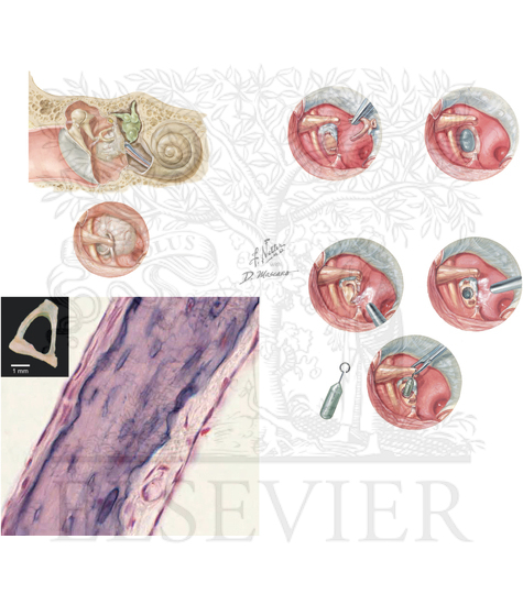 Pathology of Special Senses: The Ear