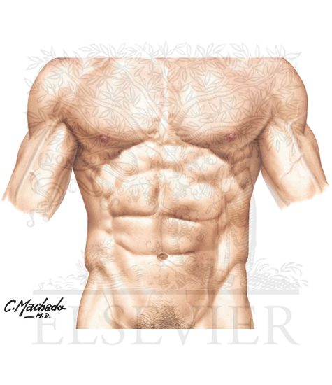 Laparoscopic Port Placement