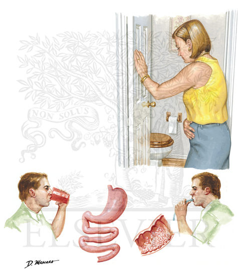 Lactose Intolerance