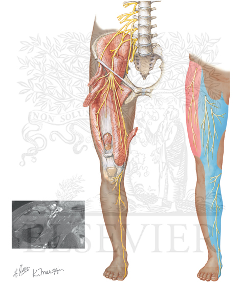 FEMORAL AND LATERAL FEMORAL CUTANEOUS NERVES