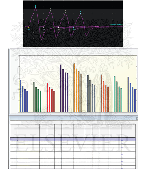 Repetitive Motor Nerve Stimulation: PATIENT WITH LAMBERT-EATON MYASTHENIC SYNDROME