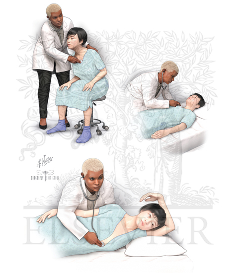 Watermarked preview of unlabeled image: Cardiovascular Examination: Positions for Cardiac Auscultation