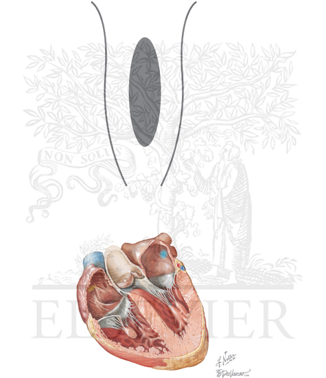 Watermarked preview of unlabeled image: Atrioventricular Nodal Reentrant Tachycardia
