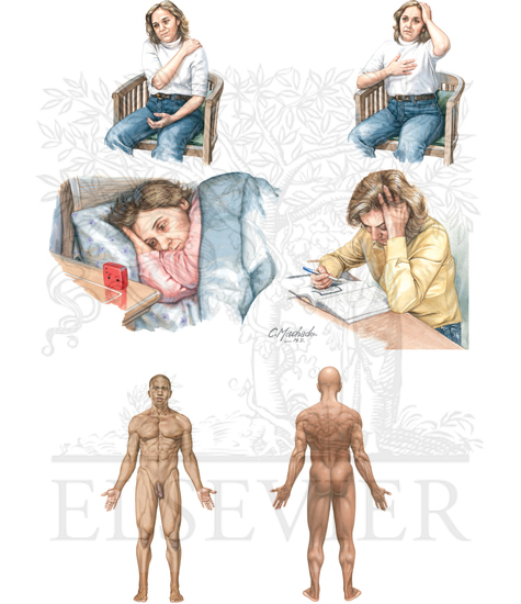 Fibromyalgia