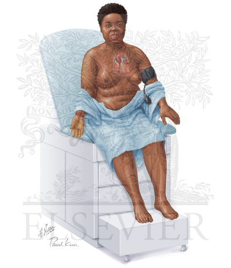 Clinical Manifestations of Hypothyroidism in the Adult