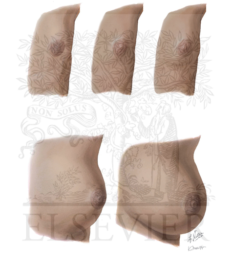 Watermarked preview of unlabeled image: Normal Puberty