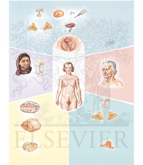 Hirsutism and Virilization (Continued)