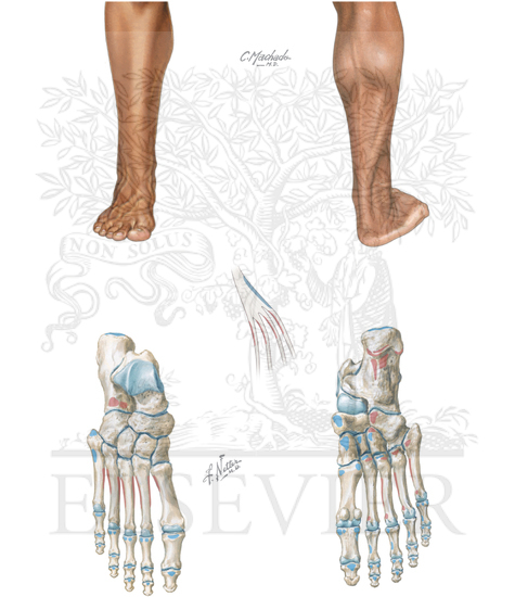 Surface Anatomy and Muscle Origins and Insertions