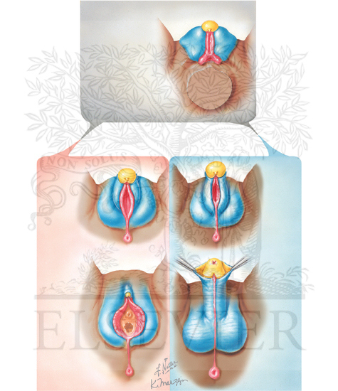 Homologues of External Genitalia