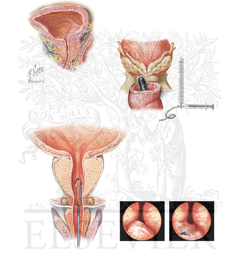 Ejaculatory duct anatomy