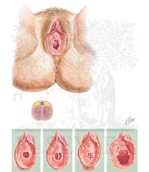 External Genitalia