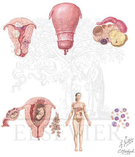 Abnormal Uterine Bleeding