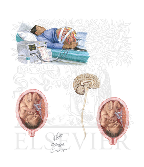 Watermarked preview of unlabeled image: Labor
