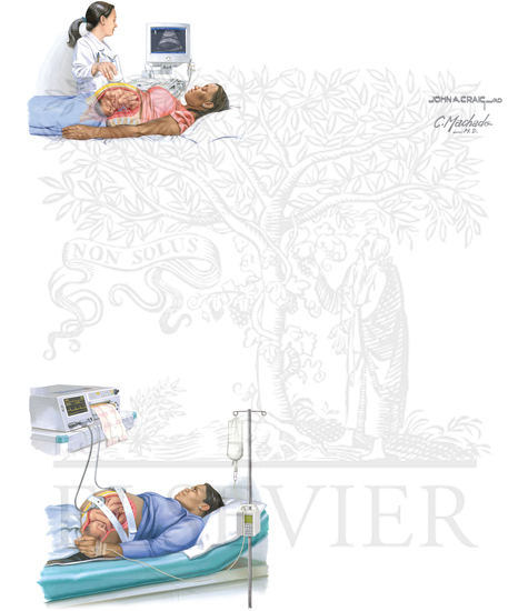 Fetal Assessment and Intrapartum Monitoring