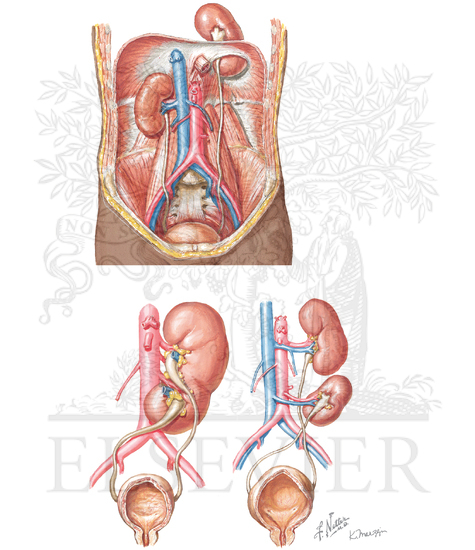 Thoracic and Crossed Ectopic Kidney 