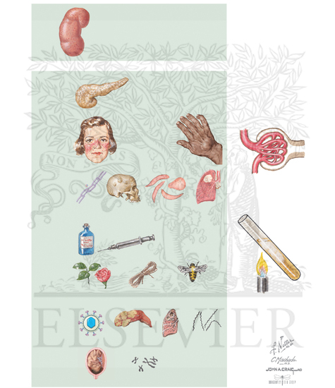 Causes of Nephrotic Syndrome