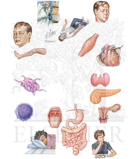 Watermarked preview of unlabeled image: Uremia