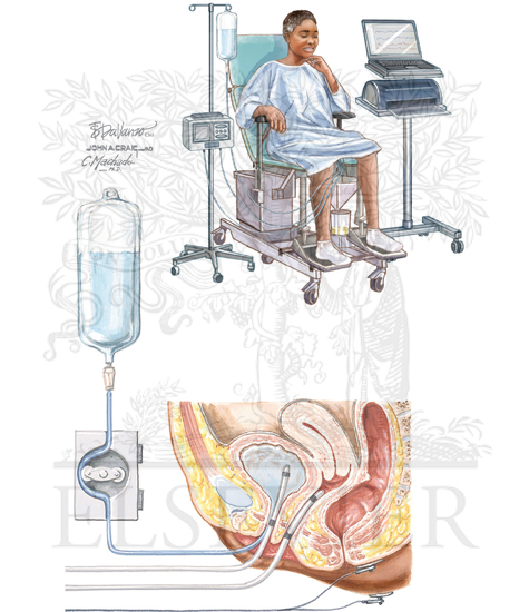 Equipment and Set-up for Urodynamics Studies