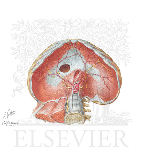 Watermarked preview of unlabeled image: Celiac artery compression syndrome (Median Arcuate Ligament Syndrome)