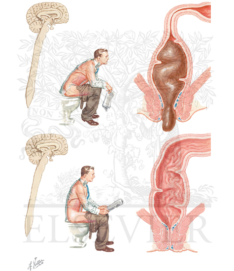 Normal Defecation
