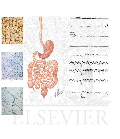 Watermarked preview of unlabeled image: Functional Constipation