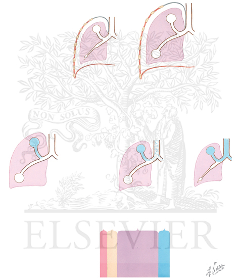 Watermarked preview of unlabeled image: Pleural Pressure Gradient and Closing Volume