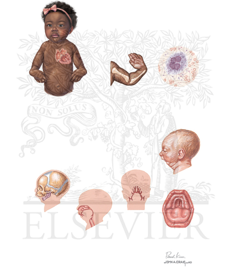 Classification of Multiple Anomalies
