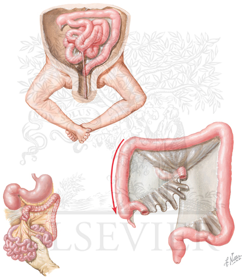 Midgut Loop