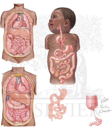 Watermarked preview of unlabeled image: Duplication, Atresia, and Situs Inversus