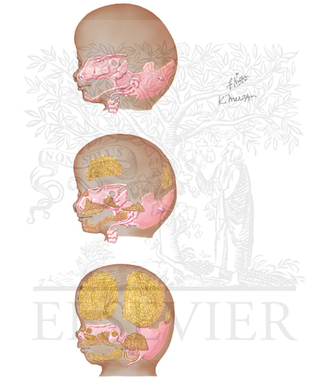 Membrane Bone and Skull Development