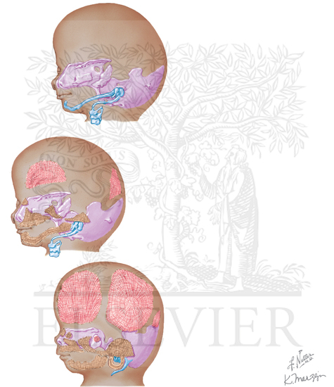Ossification of the Skull