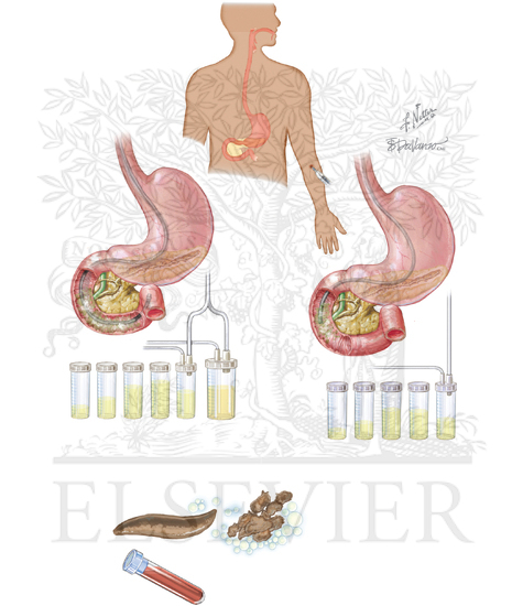 Watermarked preview of unlabeled image: Laboratory Aids in Diagnosis of Pancreatic Disease