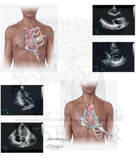 Watermarked preview of unlabeled image: Echocardiography