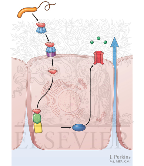 Watermarked preview of unlabeled image: Cholera