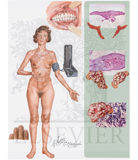 Watermarked preview of unlabeled image: Addison's Disease