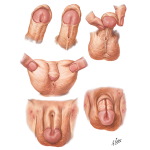 1372