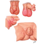 1464